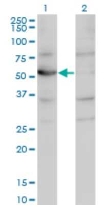 Western Blot: Cytosol Nonspecific Dipeptidase (CNDP2)/CPGL Antibody (1B1) [H00055748-M09]