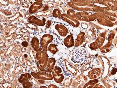 Immunohistochemistry-Paraffin: Cytosol Nonspecific Dipeptidase (CNDP2)/CPGL Antibody (210) [NBP2-90495]