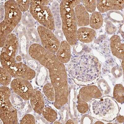 Immunohistochemistry: Cytosol Nonspecific Dipeptidase (CNDP2)/CPGL Antibody [NBP2-38337]