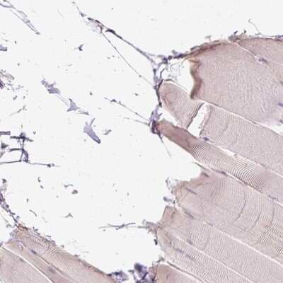 Immunohistochemistry-Paraffin: Cytosol Nonspecific Dipeptidase (CNDP2)/CPGL Antibody [NBP2-38337]