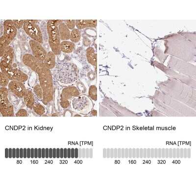 Immunohistochemistry-Paraffin: Cytosol Nonspecific Dipeptidase (CNDP2)/CPGL Antibody [NBP2-38337]