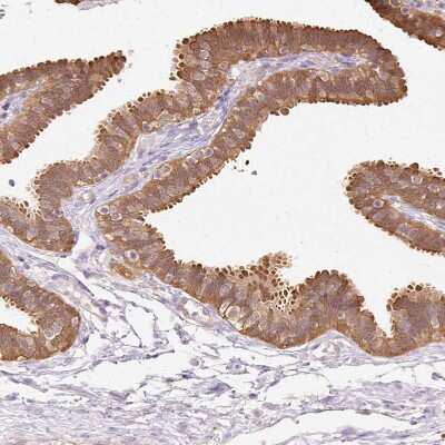 Immunohistochemistry-Paraffin: Cytosol Nonspecific Dipeptidase (CNDP2)/CPGL Antibody [NBP2-38338]