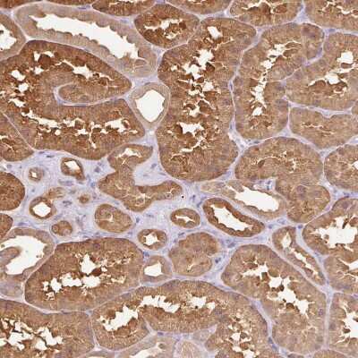 Immunohistochemistry-Paraffin: Cytosol Nonspecific Dipeptidase (CNDP2)/CPGL Antibody [NBP2-38338]