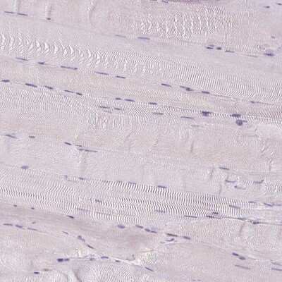 Immunohistochemistry-Paraffin: Cytosol Nonspecific Dipeptidase (CNDP2)/CPGL Antibody [NBP2-38338]