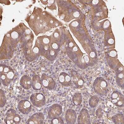 Immunohistochemistry-Paraffin: Cytosol Nonspecific Dipeptidase (CNDP2)/CPGL Antibody [NBP2-38338]