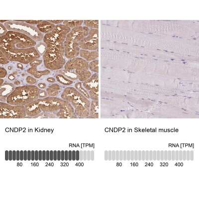 Immunohistochemistry-Paraffin: Cytosol Nonspecific Dipeptidase (CNDP2)/CPGL Antibody [NBP2-38338]