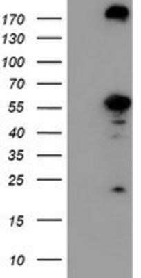 Western Blot: Cytosol Nonspecific Dipeptidase (CNDP2)/CPGL Antibody (OTI8A2)Azide and BSA Free [NBP2-72019]