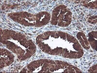 Immunohistochemistry-Paraffin: Cytosol Nonspecific Dipeptidase (CNDP2)/CPGL Antibody (OTI8A2) [NBP2-00953]
