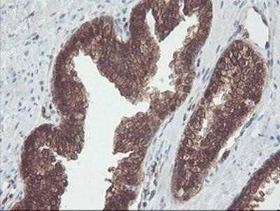 Immunohistochemistry-Paraffin: Cytosol Nonspecific Dipeptidase (CNDP2)/CPGL Antibody (OTI8A2) [NBP2-00953]