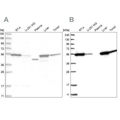 Western Blot: Cytosol Nonspecific Dipeptidase (CNDP2)/CPGL Antibody [NBP2-38337]