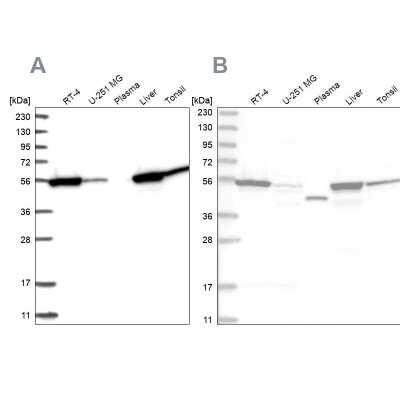 Western Blot: Cytosol Nonspecific Dipeptidase (CNDP2)/CPGL Antibody [NBP2-38338]