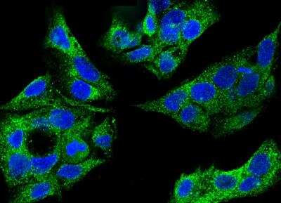 Immunocytochemistry/ Immunofluorescence: Cytosolic Sulfotransferase 1A1/SULT1A1 Antibody (034) [NBP2-89950]