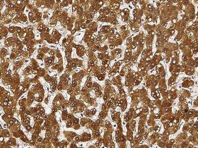 Immunohistochemistry-Paraffin: Cytosolic Sulfotransferase 1A1/SULT1A1 Antibody (034) [NBP2-89950]