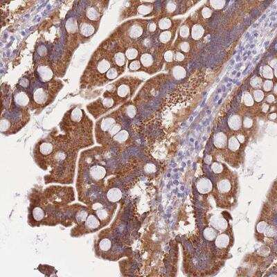 Immunohistochemistry: Cytosolic Sulfotransferase 1A1/SULT1A1 Antibody [NBP2-46774]