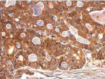 Immunohistochemistry-Paraffin: Cytosolic Sulfotransferase 1A1/SULT1A1 Antibody [NBP1-33550]