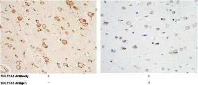 Immunohistochemistry-Paraffin: Cytosolic Sulfotransferase 1A1/SULT1A1 Antibody [NBP2-99855]