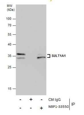 Immunoprecipitation: Cytosolic Sulfotransferase 1A1/SULT1A1 Antibody [NBP1-33550]