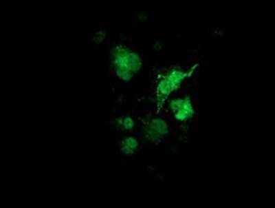 Immunocytochemistry/ Immunofluorescence: Cytosolic Sulfotransferase 1A1/SULT1A1 Antibody (OTI9B7) - Azide and BSA Free [NBP2-71308]