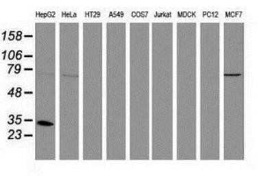 Western Blot: Cytosolic Sulfotransferase 1A1/SULT1A1 Antibody (OTI9B7)Azide and BSA Free [NBP2-71308]