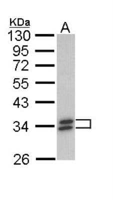 Western Blot: Cytosolic Sulfotransferase 1A1/SULT1A1 Antibody [NBP1-33550]