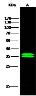 Western Blot: Cytosolic Sulfotransferase 1A1/SULT1A1 Antibody [NBP2-99855]