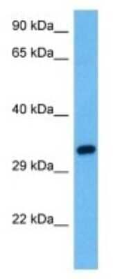 Western Blot: Cytosolic Sulfotransferase 1A1/SULT1A1 Antibody [NBP3-11010]