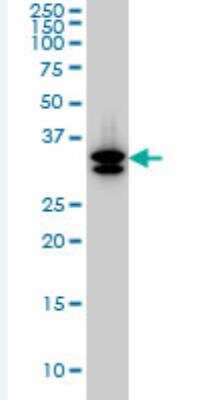 Western Blot: SULT1A3 Antibody (1B10) [H00006818-M01-100ug]