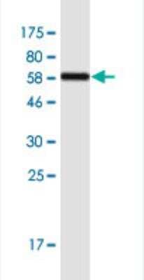 Western Blot: SULT1A3 Antibody (1B10) [H00006818-M01-100ug]