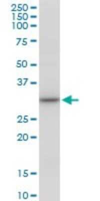 Western Blot: SULT1A3 Antibody [H00006818-B01P]