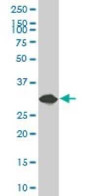 Western Blot: SULT1A3 Antibody [H00006818-B01P]