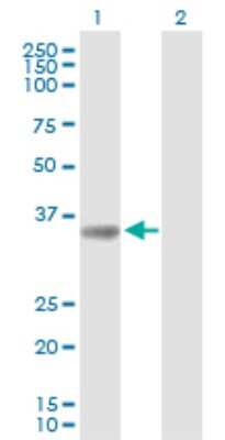 Western Blot: SULT1A3 Antibody [H00006818-B01P]