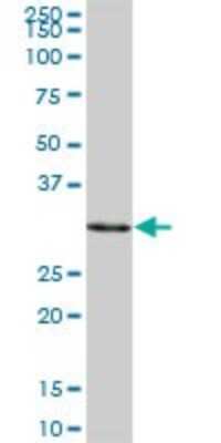 Western Blot: SULT1A3 Antibody [H00006818-B02P]