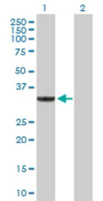 Western Blot: SULT1A3 Antibody [H00006818-B02P]