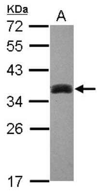 Western Blot: SULT1A3 Antibody [NBP1-31809]