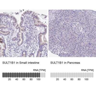 Immunohistochemistry-Paraffin: Cytosolic Sulfotransferase 1B1/SULT1B1 Antibody [NBP1-86995]