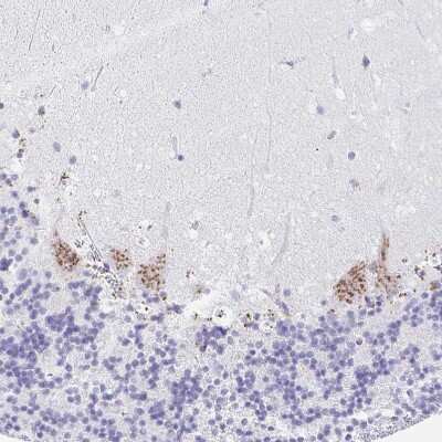 Immunohistochemistry-Paraffin: Cytosolic Sulfotransferase 1B1/SULT1B1 Antibody [NBP1-86995]