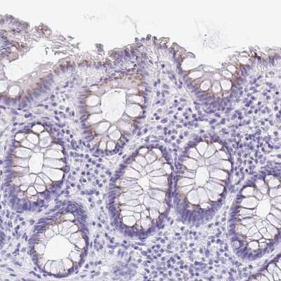 Immunohistochemistry-Paraffin: Cytosolic Sulfotransferase 1B1/SULT1B1 Antibody [NBP1-86995]