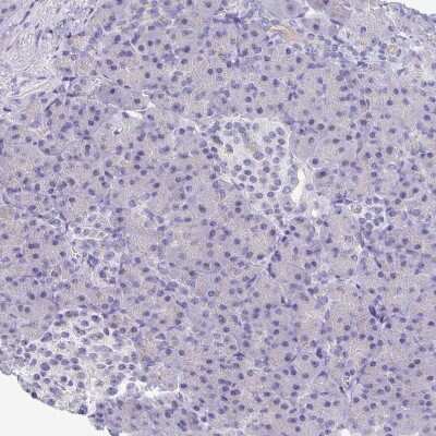 Immunohistochemistry-Paraffin: Cytosolic Sulfotransferase 1B1/SULT1B1 Antibody [NBP1-86995]