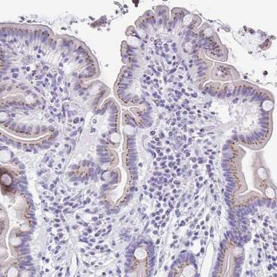 Immunohistochemistry-Paraffin: Cytosolic Sulfotransferase 1B1/SULT1B1 Antibody [NBP1-86995]