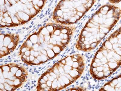 Immunohistochemistry-Paraffin: Cytosolic Sulfotransferase 1B1/SULT1B1 Antibody [NBP2-99836]