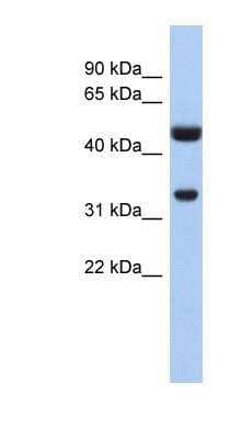 Western Blot: Cytosolic Sulfotransferase 1B1/SULT1B1 Antibody [NBP1-54403]