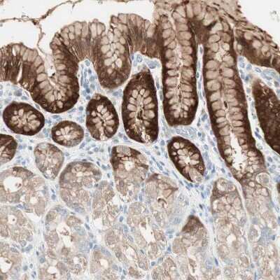 Immunohistochemistry-Paraffin: Cytosolic Sulfotransferase 1C2/SULT1C2 Antibody [NBP1-86994]