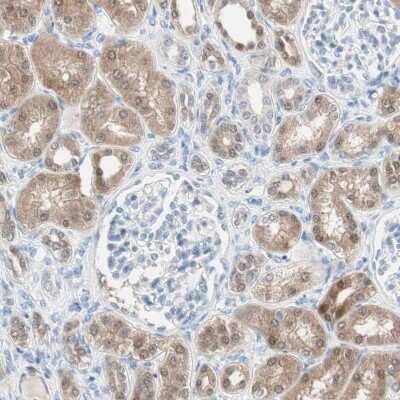 Immunohistochemistry-Paraffin: Cytosolic Sulfotransferase 1C2/SULT1C2 Antibody [NBP1-86994]