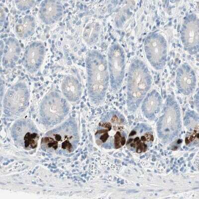 Immunohistochemistry-Paraffin: Cytosolic Sulfotransferase 1C2/SULT1C2 Antibody [NBP1-86994]
