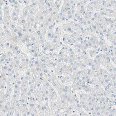 Immunohistochemistry-Paraffin: Cytosolic Sulfotransferase 1C2/SULT1C2 Antibody [NBP1-86994]
