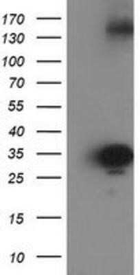 Western Blot: Cytosolic Sulfotransferase 1C2/SULT1C2 Antibody (OTI4G1)Azide and BSA Free [NBP2-71313]