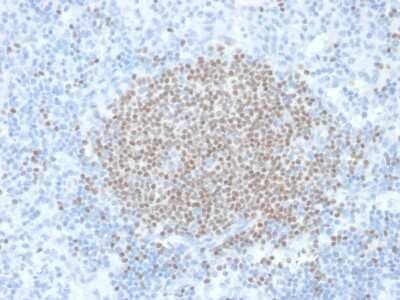 Immunohistochemistry-Paraffin: Cytosolic Sulfotransferase 1E1/SULT1E1 Antibody (CPTC-SULT1E1-1) - Azide and BSA Free [NBP3-08212]