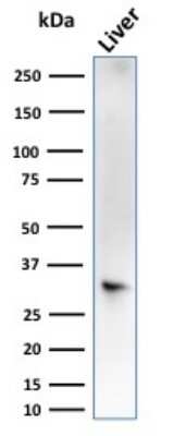 Western Blot: Cytosolic Sulfotransferase 1E1/SULT1E1 Antibody (CPTC-SULT1E1-1)Azide and BSA Free [NBP3-08212]