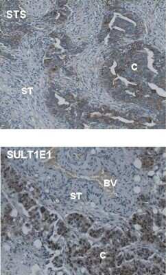 Immunohistochemistry-Paraffin: Cytosolic Sulfotransferase 1E1/SULT1E1 Antibody [NBP1-56977]