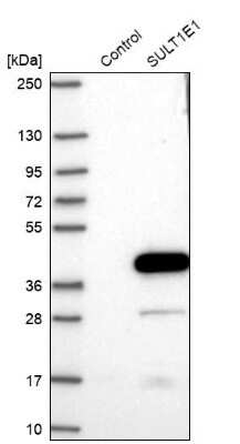 Western Blot: Cytosolic Sulfotransferase 1E1/SULT1E1 Antibody [NBP1-84785]